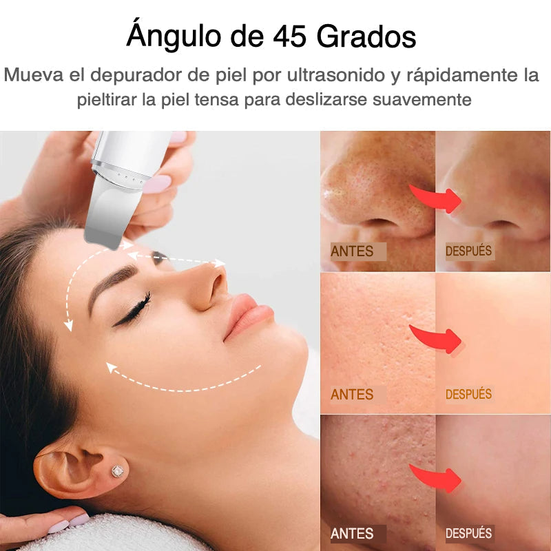 Ultrasonic Exfoliator for Radiant Skin