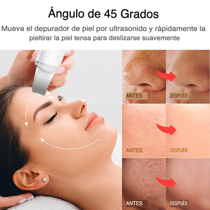 Ultrasonic Exfoliator for Radiant Skin